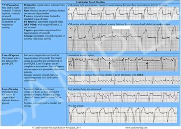 A Visionary In Cardiac Arrhythmia Management