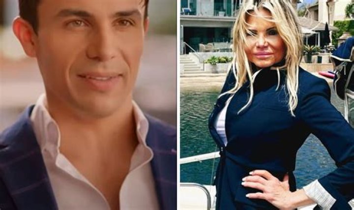 Gio Helou Mom Plastic Surgery: A Journey Of Transformation