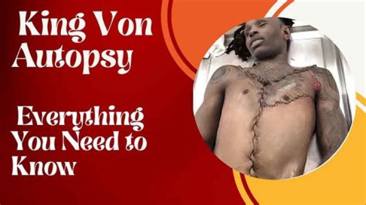 King Von Autopsy Reveals Hidden Details