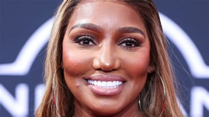 RHOA viewers urge NeNe Leakes to stop with the cosmetic surgery