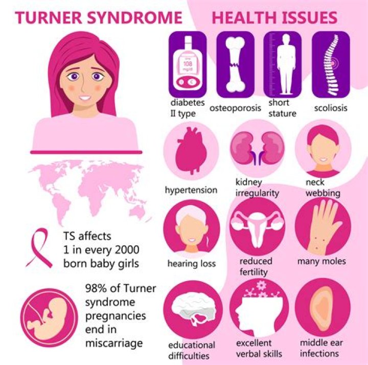Turner Syndrome Celebrities: Uncovering Triumphs And Inspiration